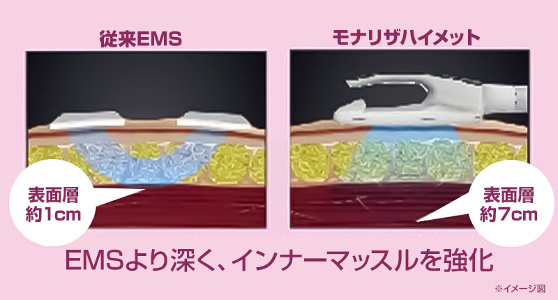 モナリザハイメットのイメージ図